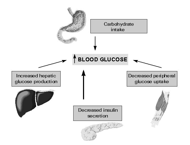 http://img.medscape.com/pi/emed/ckb/endocrinology/116364-138563-123702-1685907.jpg