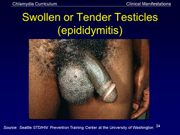 swollen or tender testicles (epididymitis)