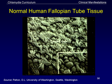 normal human fallopian tube tissue